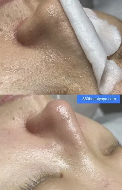 360 Beauty Spa - Head Spa