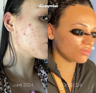SkinByMiso Salon & Med Spa - Head Spa