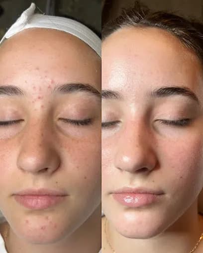 La Vie Esthetics Bar - Head Spa