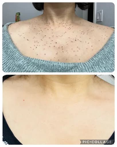 Flawless Skin Care - Head Spa (Kale Salon Suites) - Head Spa