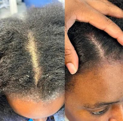 Scalphq Head & Scalp Spa - Head Spa