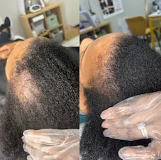 NHCG Trichology - Head Spa
